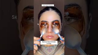 Remove Dark Circles Naturally At Home In 1DayUnderEye Dark Circles Remove Homeremedy dark shorts [upl. by Drais]