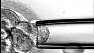 BIOPSIA EMBRIONARIA PGDmpeg [upl. by Nomyaw]