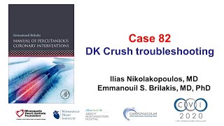 Case 82 PCI Manual  DK crush troubleshooting [upl. by Aigroeg]