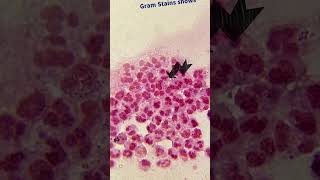 Gram Stain Smear  Neisseria gonorrhoeae  Microbiology science biology microbiology medical [upl. by Ennaimaj]