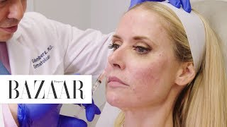 Umbilical Stem Cell Treatment  The Younger Games  Harpers BAZAAR [upl. by Flannery]