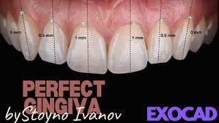 How to Design the Perfect Gingiva in EXOCAD [upl. by Darahs434]