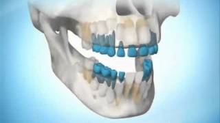 OPCI SALUD CRONOLOGÍA DE LA ERUPCIÓN DENTALwmv [upl. by Akerdna]