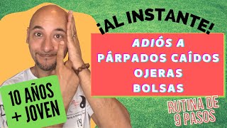 ¡REJUVENECE 10 AÑOS SIN PÁRPADOS CAÍDOS NI OJERAS NI BOLSAS  9 Minutos al Día [upl. by Mencher]