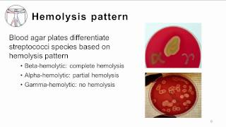 GAS pharyngitis Microbiology and Lab techniques [upl. by Autrey]