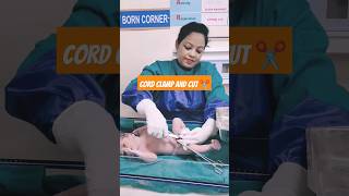 cord clamp and cut after delivery of babynewbornshortsvideo [upl. by Kered]