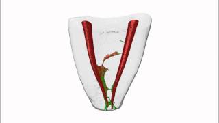 Root Canal Preparation Mandibular Molar by Dr Versiani amp Dr Keles [upl. by Tierza972]