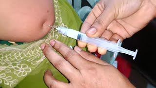 Arm injection IM Soma Ject Injection Push √√ Injection Video জন্মবিরতিকরণ ইনজেকশন 24 Ep 53 [upl. by Eelyam488]