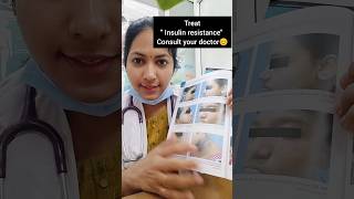 Read the description drdivya doctor drdivyat acanthosisnigricans darkneck healthtipinkannada [upl. by Sanford]