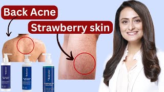 My Verdict on the Be Bodywise Bodycare Range for Back Acne amp Strawberry Legs [upl. by Sanyu]