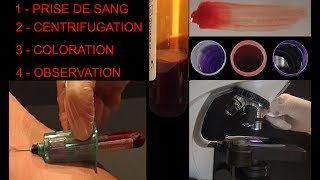 Prise de sang humain  Centrifugation  Frottis  Coloration  Observation SVT Hervé Kempf [upl. by Kissiah]