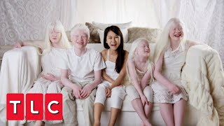 This Couple Adopted Four Children With Albinism  Born with Albinism [upl. by Longley]