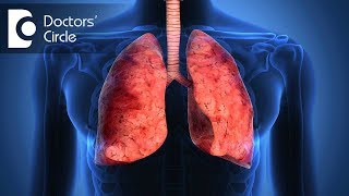 What are causes of Pulmonary Fibrosis  Dr Hirennappa B Udnur [upl. by Nivaj]