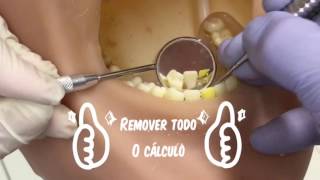 Periodontia raspagem e afiação de instrumental [upl. by Yvan]