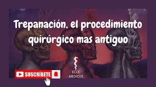 Trepanación el procedimiento quirúrgico mas antiguo [upl. by Jana447]