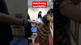 Ankylosing spondylitis treatment 93085113578409313131 drrajneeshkant [upl. by Moreta]