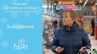 Vivre avec un handicap invisible  La sclérodermie mon quotidien [upl. by Llemrej]