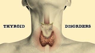 Thyroid Disorders [upl. by Lally350]