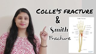 Colles fracture in hindi  smiths fracture in hindi  easy explanation  Anatomy easy videos [upl. by Rezzani]