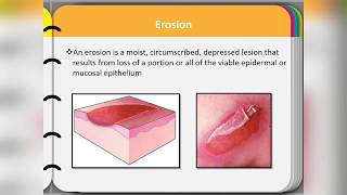 Skin Lesions Description [upl. by Nareik952]