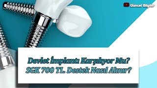 Devlet İmplantı Karşılıyor Mu SGK 700 TL Destek Nasıl Alınır [upl. by Spatz592]