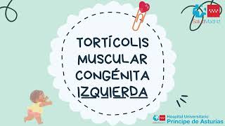 Tortícolis muscular congénita izquierda [upl. by Siddra196]