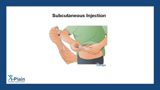 Subcutaneous Injection [upl. by Pages434]