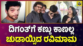 ದಿಗಂತ್ಗೆ ಕಣ್ಣು ಕಾಣಲ್ಲ ಚುಡಾಯ್ಸಿದ ರವಿಮಾಮ  Diganth Eye Injury  Aindrita Rai Husband  Ravichandran [upl. by Hadias]