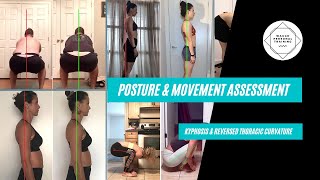 Kyphosis amp Reversed Thoracic Curvature  Posture Assessment  Waugh Personal Training [upl. by Jak183]