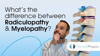 What’s the difference between Radiculopathy and Myelopathy  Expert Physio Guide [upl. by Ihc258]