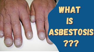 Asbestosis Asbestos disease Sign amp Symptoms Causes and risks [upl. by Magdalen]