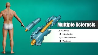 Multiple sclerosis  causes symptoms diagnosis treatment pathology [upl. by Mckinney]