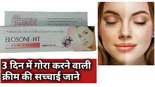 Best Cream Gora Hone Ki ElosoneHT Skin Cream  ElosoneHT Skin Cream Reviews Use In Hindi [upl. by Pascia865]