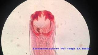 Ancylostoma caninum ♂ Vista dorsal [upl. by Sivatnod]