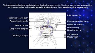 Hood Technique for Robotic Radical Prostatectomy [upl. by Weibel373]