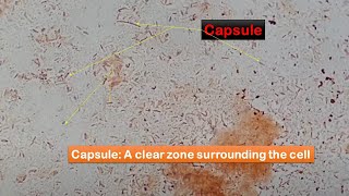 Capsule of bacteria observation in Capsule Stained smears of culture [upl. by Akinal]