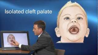 Cleft Treatment  Pediatric Playbook  Boston Childrens Hospital [upl. by Mag]