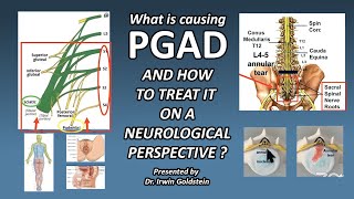 Understanding PGAD Exploring SpineRelated Causes and the Role of Neurogenital Testing in Treatment [upl. by Cyndy]