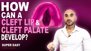 Cleft Lip vs Cleft Palate Easy to Understand [upl. by Crary572]