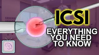 IVF ICSI Procedure  Important things you need to know [upl. by Ahsiri]