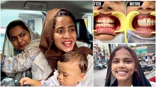 Finally Sunu Molude Teeth Braces Remove Cheithu 😬😍  Mashura  Basheer Bashi  Suhana [upl. by Towney]