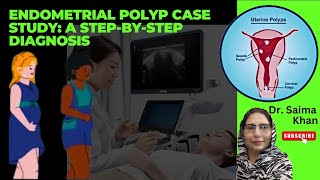 Endometrial Polyp Case Study A StepbyStep Diagnosis health ultrasound polyp DrSaimakhan [upl. by Ji]