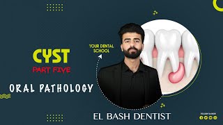 pseudo cysts  part 5  oral pathology  عزت شومان [upl. by Yacov]