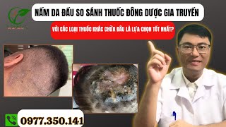 Nấm Da Đầu So Sánh Thuốc Đông Dược Gia Truyền Với Các Loại Thuốc Khác Chữa Đâu Là Lựa Chọn Tốt Nhất [upl. by Nnoryt]