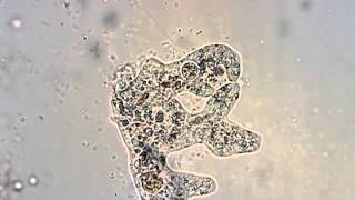 Amoeba from a pond in Oregon feeding and division [upl. by Leroi241]