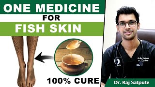 One Medicine To Cure Ichthyosis Vulgaris FISH SKIN  How to Cure FISH SKIN Naturally amp Permanently [upl. by Cati]