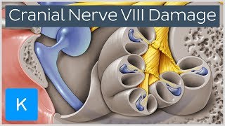 What happens when the vestibulocochlear nerve is damaged  Human Anatomy  Kenhub [upl. by Balch125]