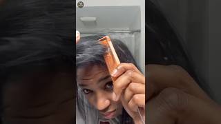 Dandruff removal at home 🏡 [upl. by Purse]