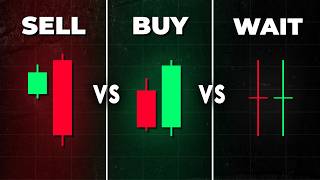 The BEST Candlestick Pattern Guide Youll EVER FIND [upl. by Massimiliano]