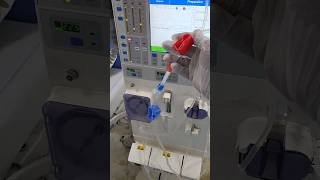 What are the benefits of Recirculation in dialysis Comment Answer please [upl. by Alil966]